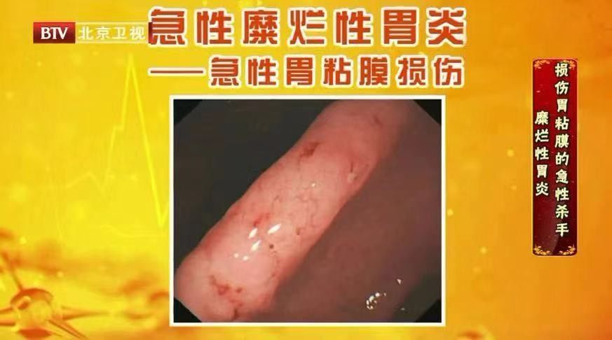 胃病|胃病无小事，一不小心可能拖成癌！有这些迹象要及时就诊