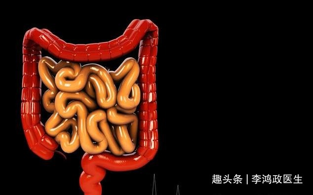 胰腺癌|女子口渴、尿多,以为是糖尿病,直到上腹部不适医生才发现是癌症