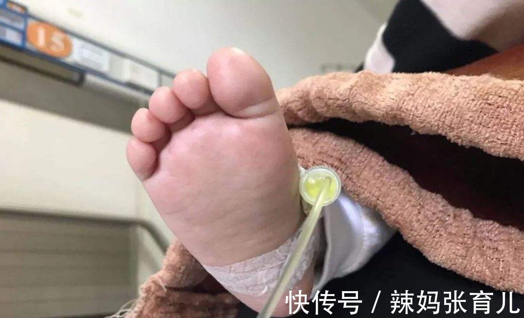 宝宝|原本以为夏季才是手足口病的高发期,没想到冬季也是