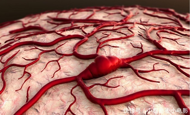 血脂异常|血脂高能吃蛋黄吗?91岁院士忠告:若是想要远离脑梗,少吃3素