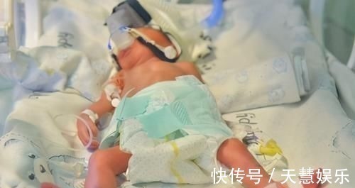 济南第二医院|32岁孕妇舍命生五胞胎，最小的仅鸡蛋一般大，令人揪心的纪录片！