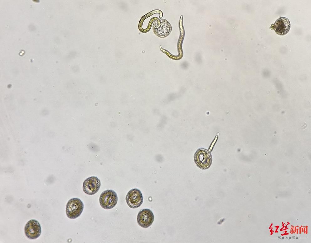 蛔虫病|8岁男孩被诊断为全球首例患者，专家提醒：养狗家庭要特别注意