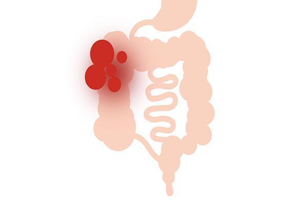 月经紊乱|45岁是个尴尬的年龄,如果还有五个表现,恭喜你,更年期还早着呢