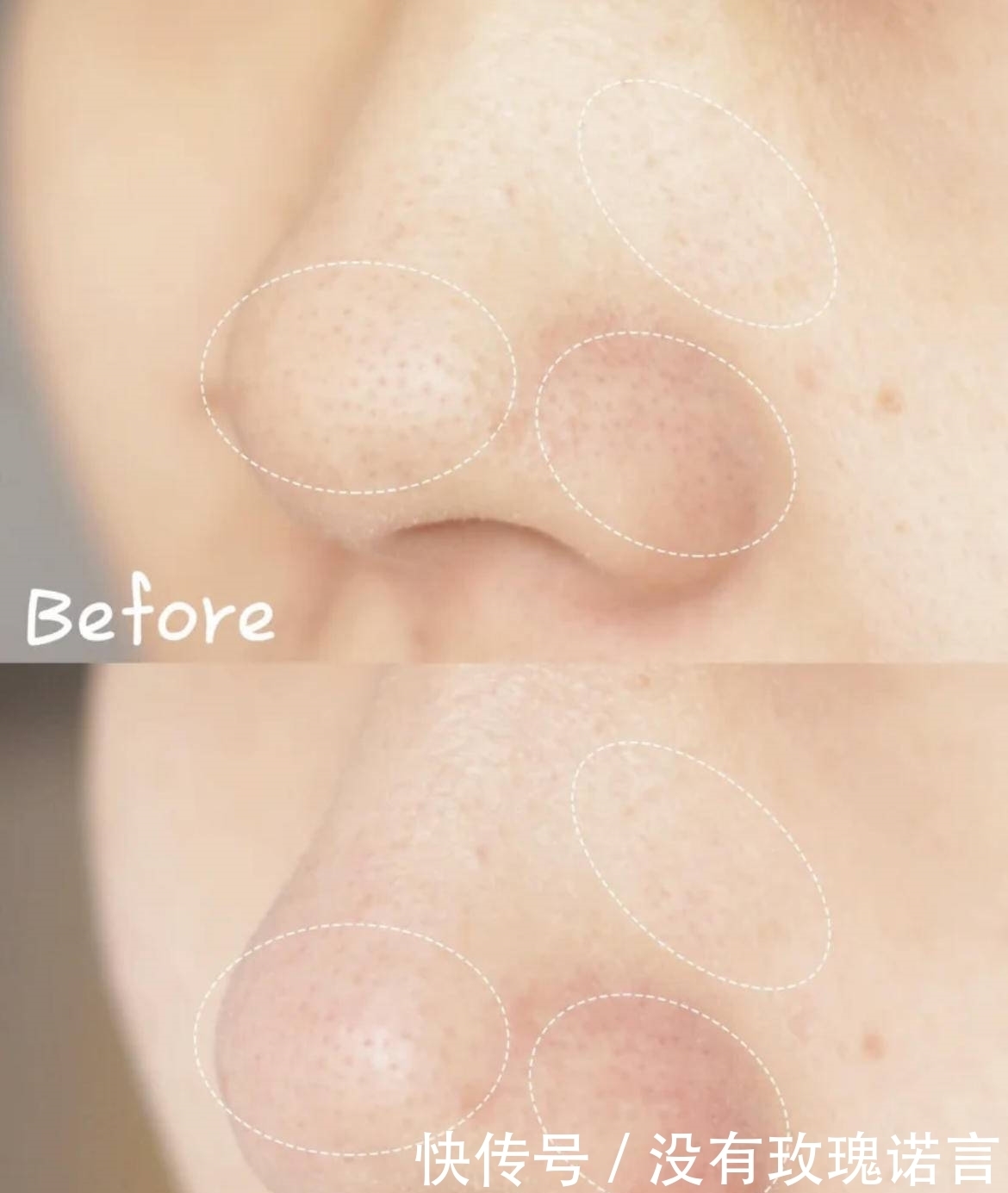 这些清洁面膜如果停产了,我简直世界崩塌!