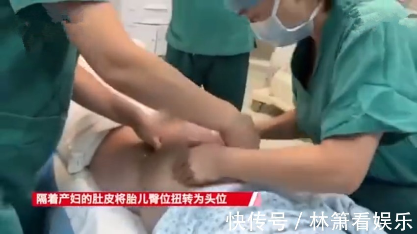 总之孕|堪称魔术!1分钟剖宫产变顺产,医院产房上演胎位“乾坤大挪移”