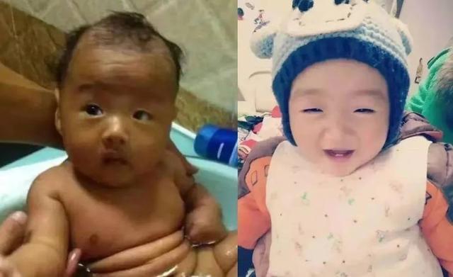 宝宝|“最美新生儿”刚出生就成网红,凭颜值征服网友,护士:难得一见