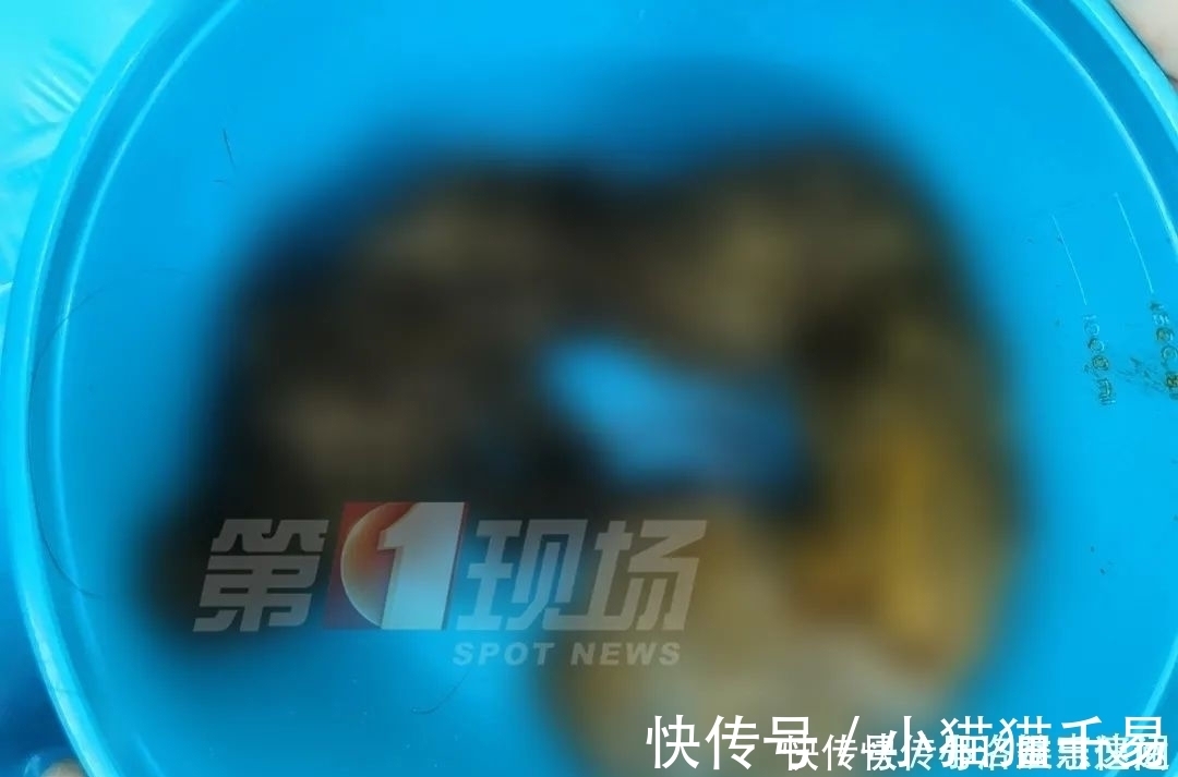 手术治疗|头皮发麻14岁女孩胃里竟塞满…这个可怕习惯她保持了十年