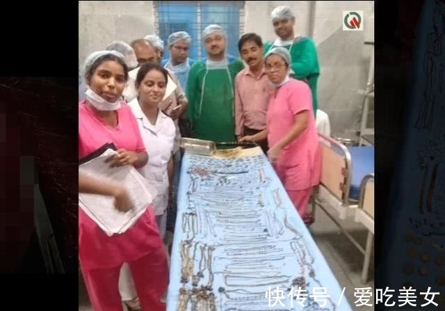珠宝|印度一女子身体里竟取出价值45万的珠宝:69条链子,80个耳环