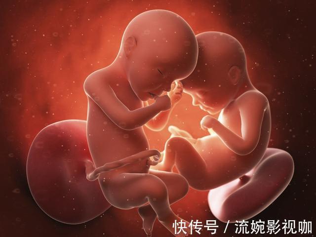胎儿|7岁女孩后背长个“包”，父母带娃去医院检查，医生三胞胎老大