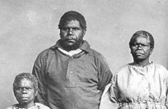 塔斯!丈夫被展览,她留下遗愿,求别解剖展览她,死后还是被观赏72年