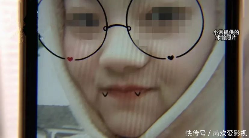 漂亮姑娘刚怀孕,鼻尖出现神秘白色物体!婆婆追问下,她瞒不住了…