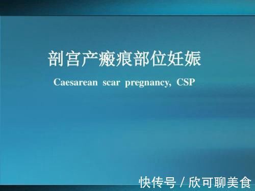 子宫破裂|“顺产再好,我也不选”,95后孕妈给出的理由,让人很难反驳
