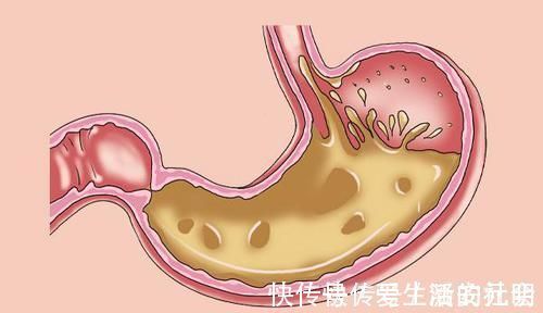 少喝|陈皮有“良配”,经常拿来一起泡水喝,养肝排毒,调血脂滋养脾胃
