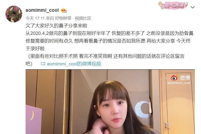 UZI女友公开整容经历，鼻子是肋骨鼻，侧面有点吓人了！