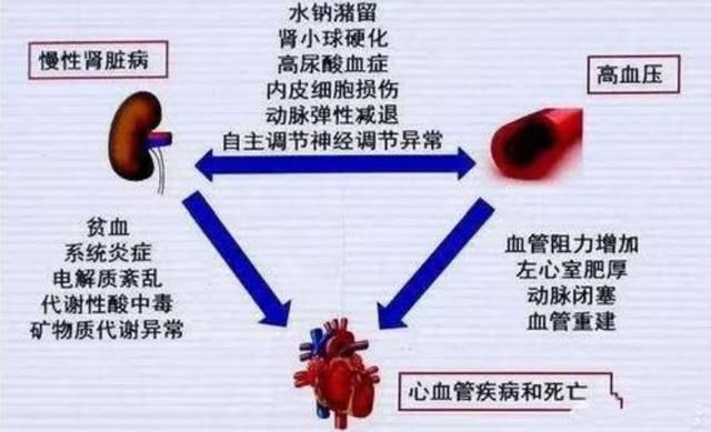 血压高了不要慌，不妨尝试一下这4个办法，或能帮到你