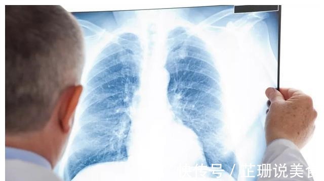 王教授|北大人民医院刘医生父亲查出了肺癌,希望放弃治疗,我没同意