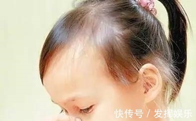 鼻孔|家长必须提高警惕:小孩流鼻血原来是这个原因