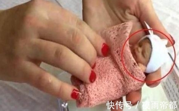 保育箱|18年前那个只有25厘米,体重才半斤的女孩,如今怎样了?