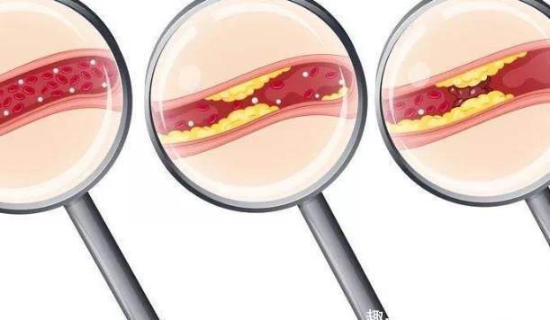 常生活中|身体两个地方越软,活的寿命就越长久,你看是哪两个地方!