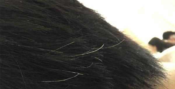 白发|身体好不好，看头发就知道，白发的生长位置，暴露了你的身体情况