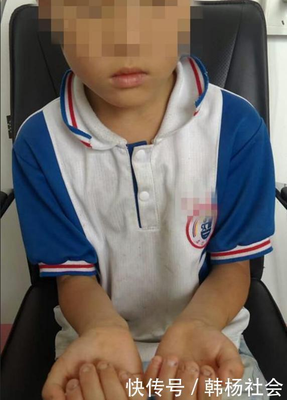 表姐|从小“咬指甲”的孩子,长大后怎么样了专家逃不掉2种结局