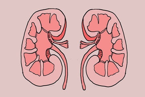 健康|排尿很黄，异味很大多半是身体发出“求救信号”，别以为是上火