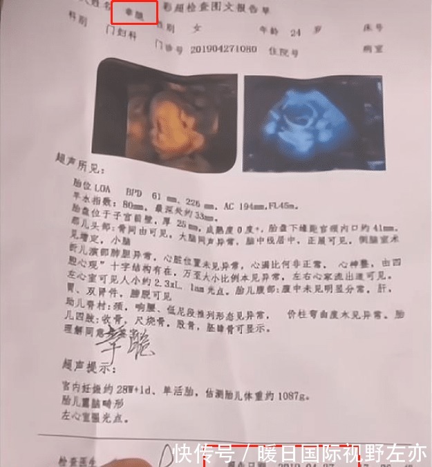 牛爱芳晒妻子孕检单,却隐藏关键信息,吃鱼只吃鱼尾,真豪气!