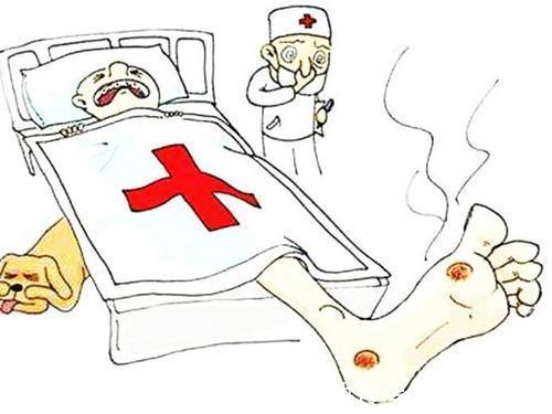 周围神经|糖尿病友腿部出现这九种情况要担心，可能糖尿病足，七点来预防