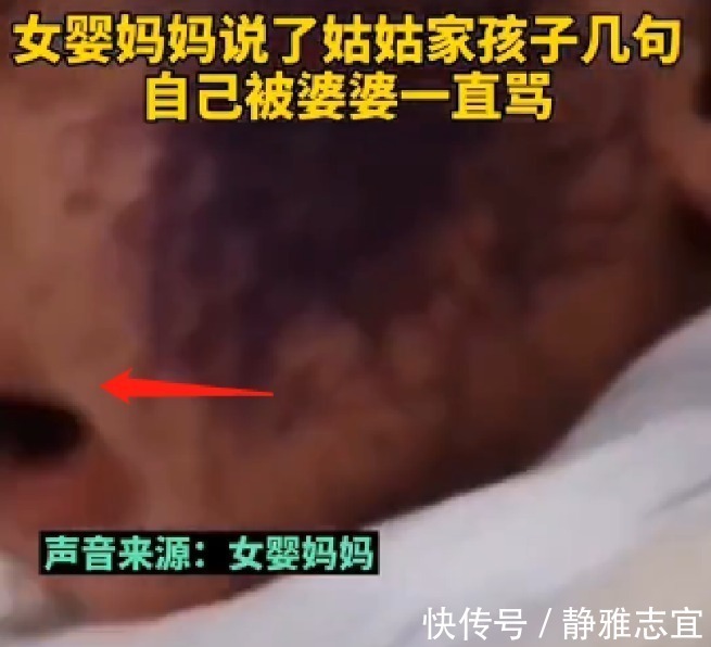 姑姑|满月女婴遭亲戚孩子乱涂乱画，脸上全是墨水，亲戚：和孩子较啥劲