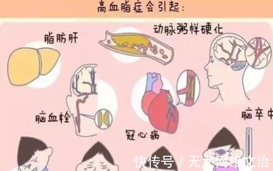 克星|高血脂“克星”公开,避免做这几件事,血管干净通畅