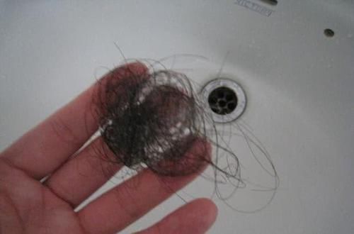 头皮|一天中什么时候洗头发会头疼、掉发？多数人做法不对，要及时纠正