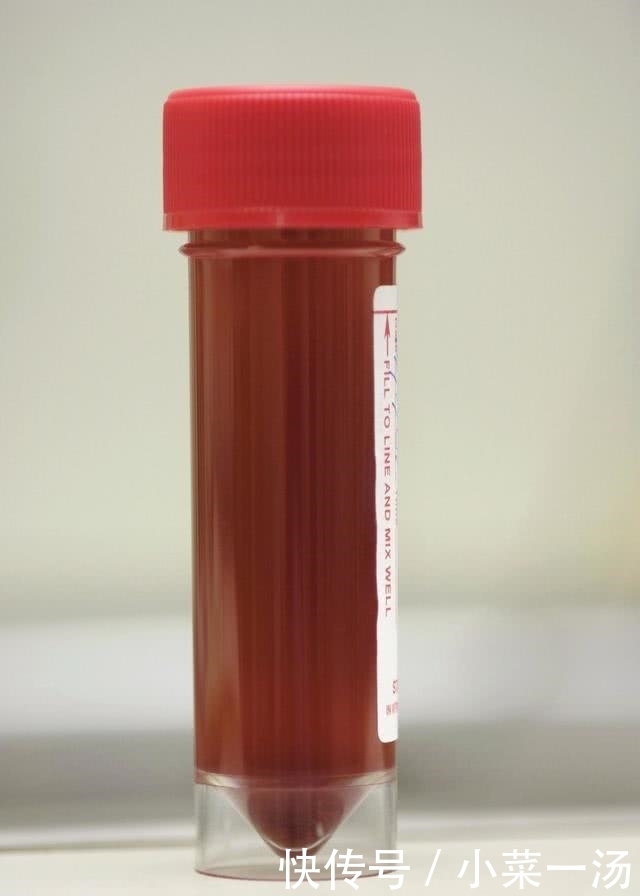 为何尿毒症越来越多?原因不外乎这“3个字”,别怪没人提醒!