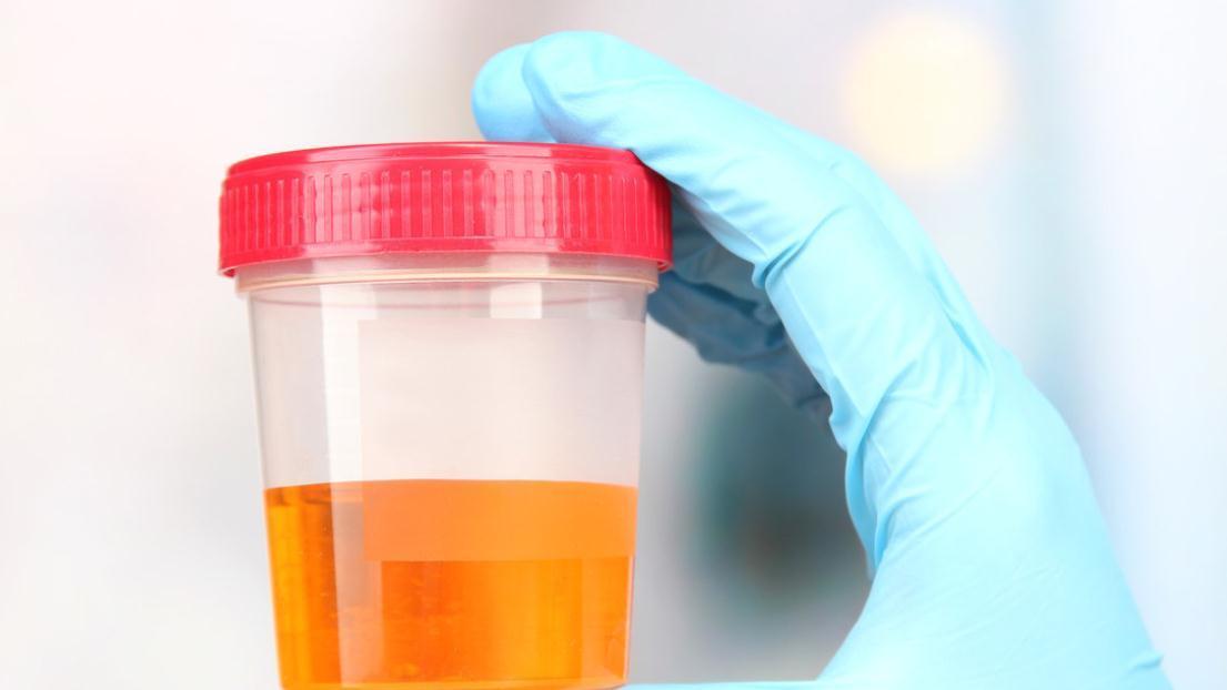 肾病|糖尿病16年，血糖稳定在6.1，赶走肾病，无并发症，方法有2点