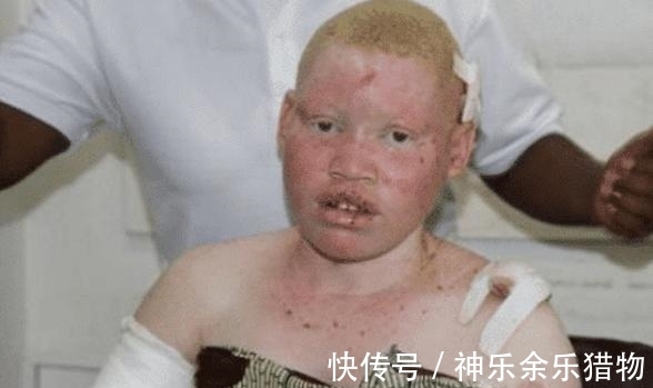 警察|被人当成“唐僧肉”，血液比金子还贵，警察只能24小时保护他们