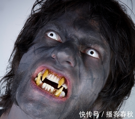 怪物|七岁男孩嘴中有526颗牙齿,医生花费5小时取出,和怪物没区别