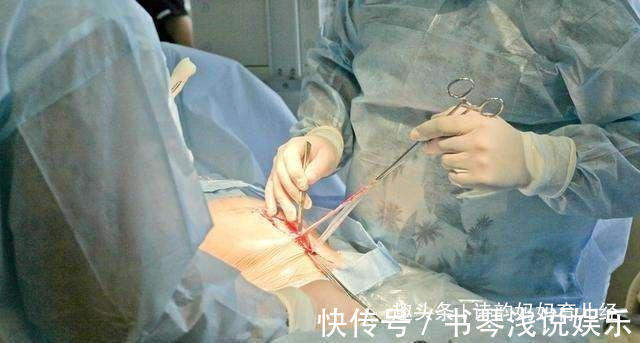 晴子|剖腹产手术中,医生还会顺带帮你做这几个手术,看看你中标了吗?