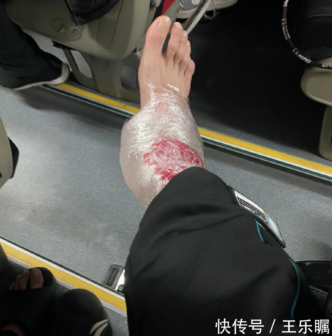 投篮|郭艾伦回应被垫脚,防投篮应收脚保护对手,都是朋友盼以后多注意