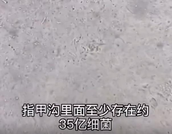 手指|孩子啃指甲到底会吃下去多少“细菌”?网友直呼看完后头皮发麻!