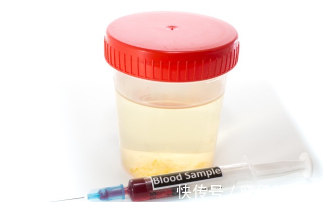 牛油果|男子因996血脂过高差点瘫痪,提醒:2种水果慎吃,4种食物常吃