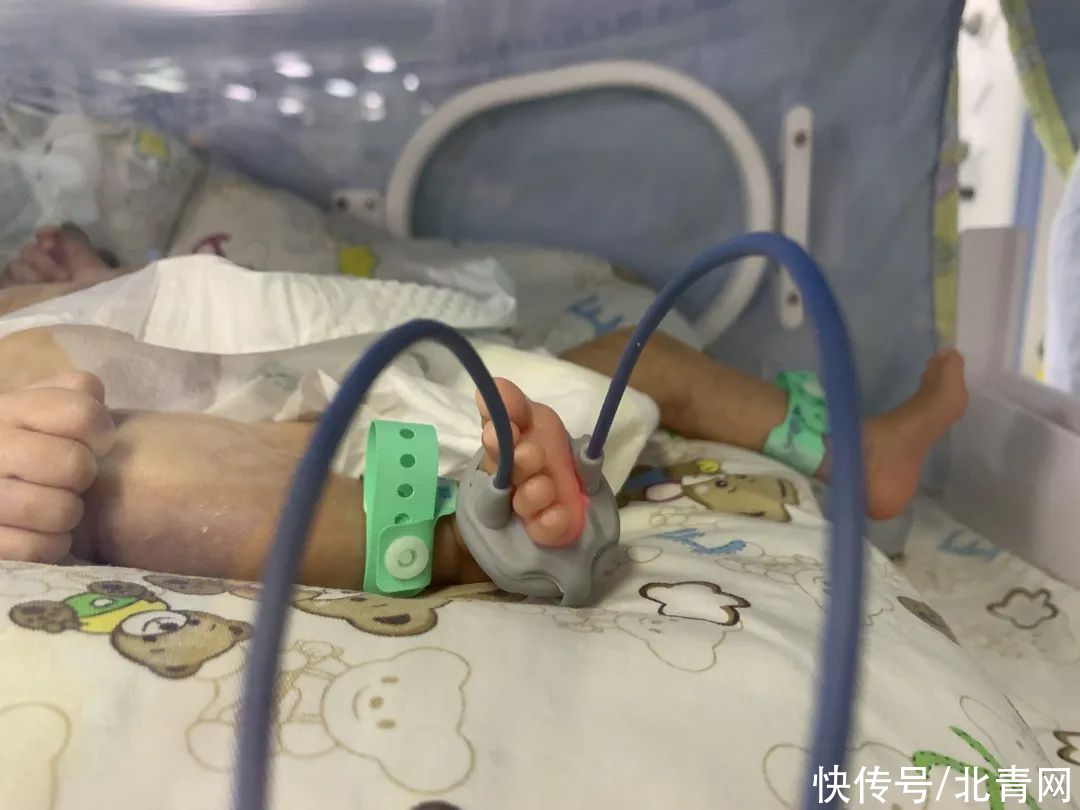 楠楠|柳州“巴掌公主”视网膜病变，医院开通绿色通道守护“心灵之窗”