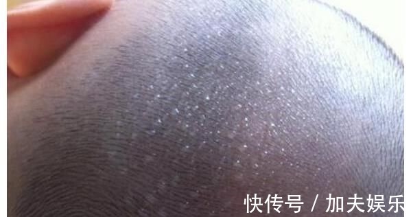 脾衰|5岁男孩咳嗽不停,查出脾衰,医生:这3种食物吃一次1周不消化