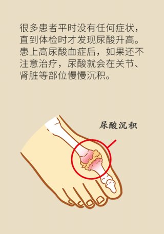 这种疾病会使你痛不欲生,医生教你如何早发现早远离