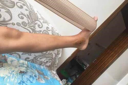 植物蛋白|骨科医生不想骨头又脆又软,常吃3物,做1事,到老不骨质疏松!