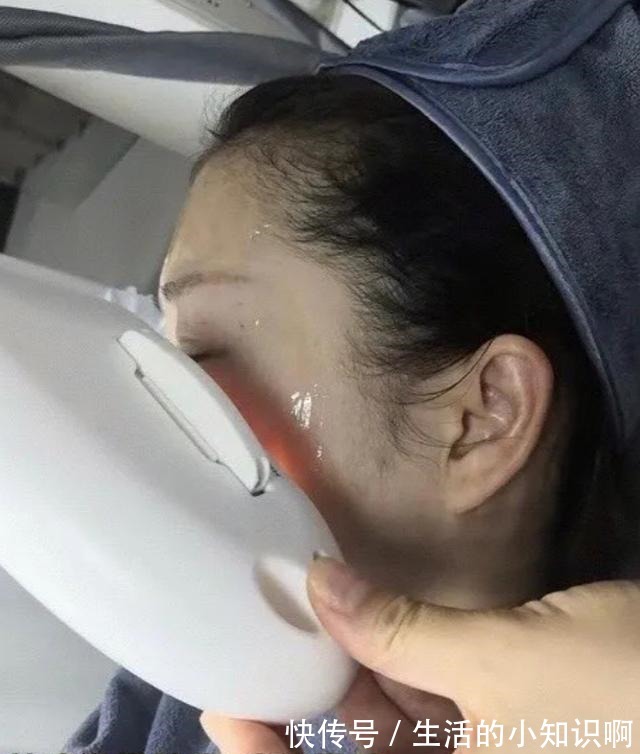 痤疮 做医美能把皮肤做好吗!