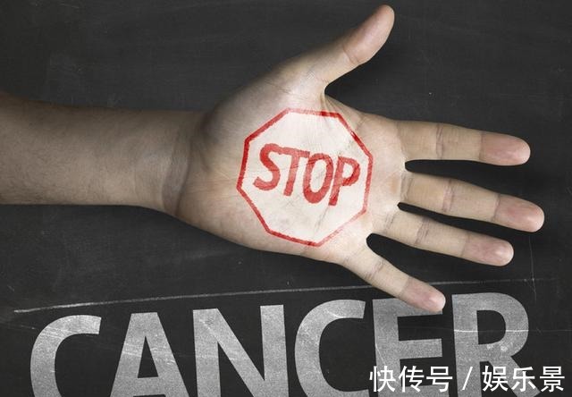 癌症患者|术后1-3年是癌症复发高峰能不能完全治好,要看这几点