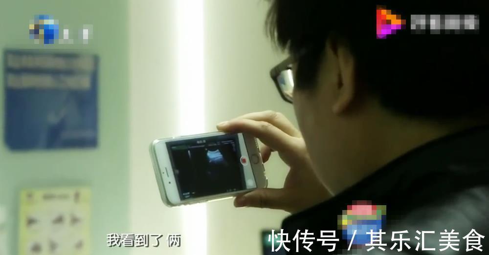 宝宝|四维彩超背后隐藏的几个“误区”，孕妈别再傻傻相信了，真没必要