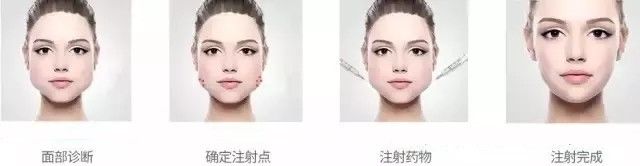 注射量 精致小V脸迷倒一片，瘦脸针的那些真相，想打？你应该懂！