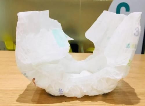 屁屁|婴儿“红屁屁”住院20多天,差点要植皮,医生:都是家长粗心闹的