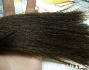 截肢|宝爸宝妈们,这些东西你家都有,它可能会导致宝宝面临截肢!