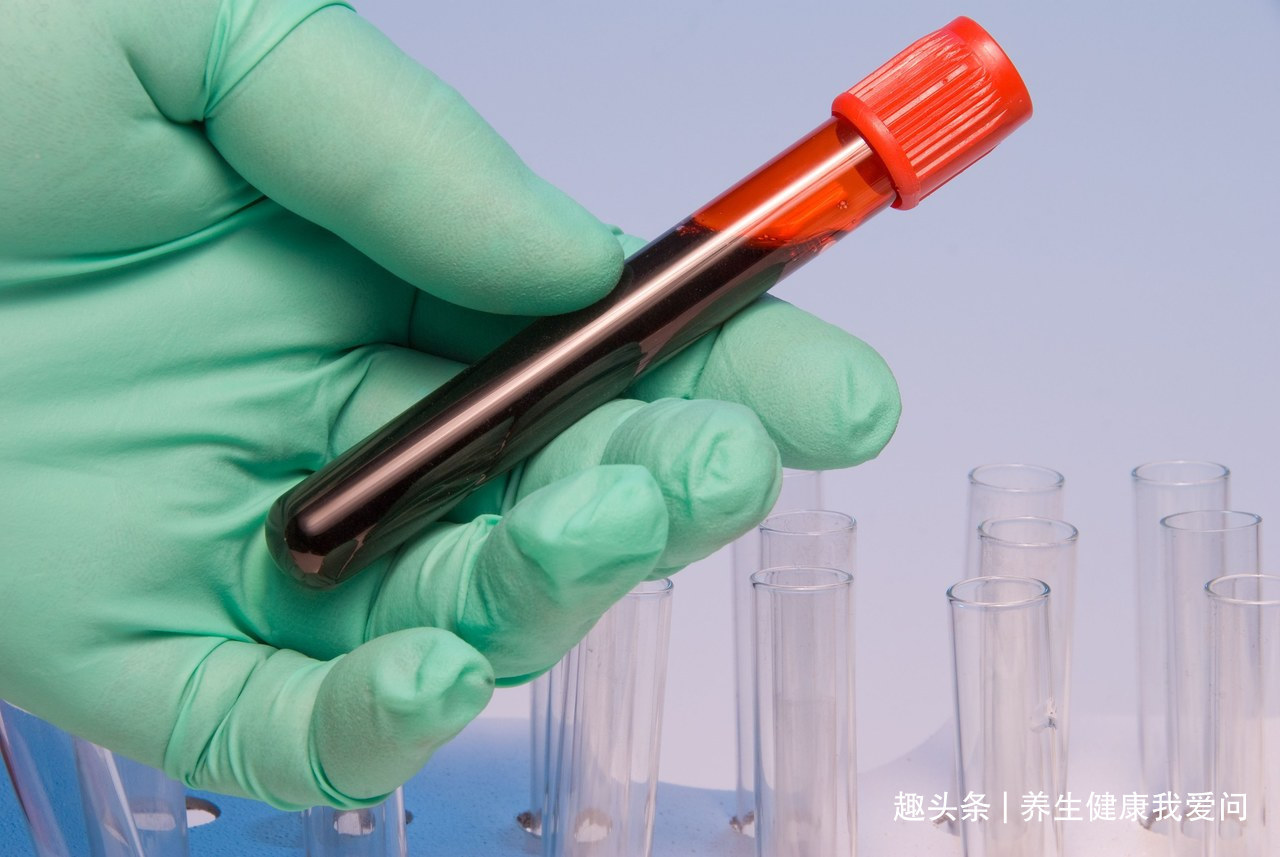 癌症|血型决定患癌几率和寿命A型、B型、AB型、O型，哪种更长寿
